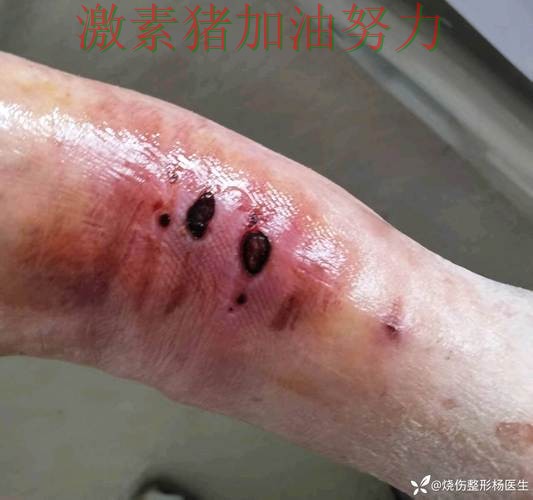 雄鹿防线告急球队隐患再次暴露 雄鹿防线告急球队隐患再次暴露